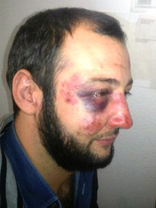 Али Хазбиев со следами избиения на лице. Фото с независимого сайта ingushetiyaru.org