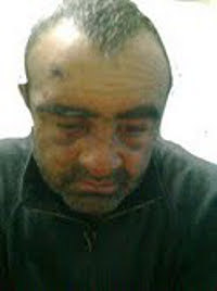 Хасан Хубиев после следственных действий в изоляторе МВД Черкесска.  Фото очевидца.