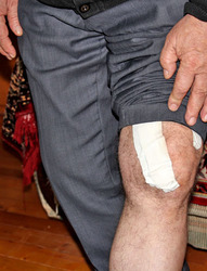 Во время взрыва Исаков получил осколочные ранения в ногу. Хасавюрт, 6 января 2014 г. Фото Махача Ахмедова для "Кавказского узла"
