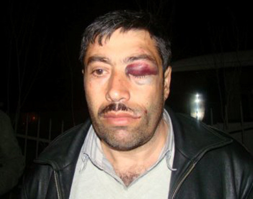 Тазахан Мираламли после его избиения в Ясамальском районном управлении полиции. Азербайджан. Фото газеты "Азадлыг" ("Свобода")