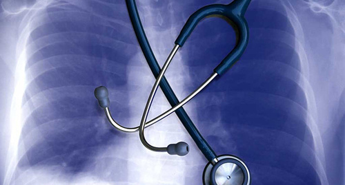 Рентгеновский снимок и фонендоскоп. Фото: http://deshuna.com/people-lung-cancer-dont-deserve-die/