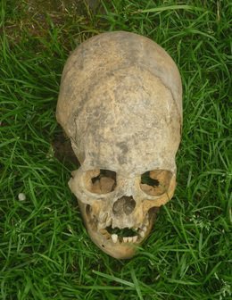Обнаруженный в некрополе деформированный череп. Фото предоставлено "Кавказскому узлу" Виктором Котляровым.