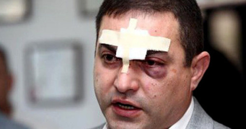 Адвокат Армен Согомонян, подвергшийся нападению. Фото http://news.day.az/world/891031.html