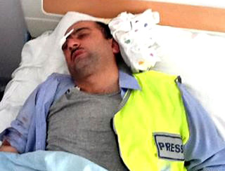 Журналист Идрак Аббасов был жестоко избит. Баку, 18 апреля 2012 г. Фото ИА «Туран»