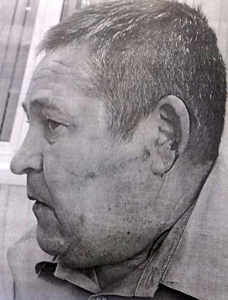 Владимир Кривошеев впервые представил фото в суд с окровавленным ухом перед вынесением приговора.  Фото предоставлено Владимиром Кривошеевым