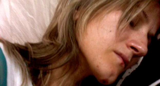 Сапият Магомедова после избиения. Фото предоставлено Правозащитным центром "Мемориал"
