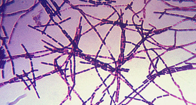 Микрофотография бацилл сибирской язвы. Окраска по Граму. Источник: http://ru.wikipedia.org