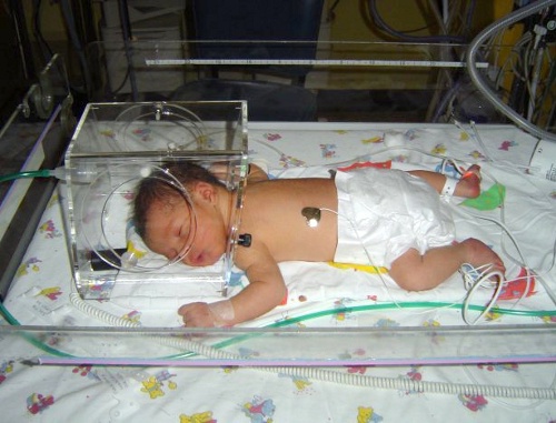 Новорожденный в инкубаторе. Фото: croftsfamily.com