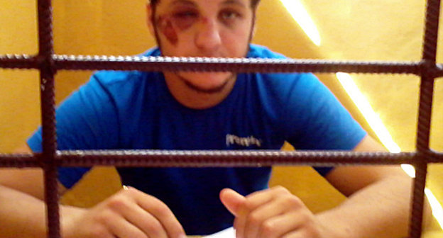 Анвар Гусейнов после его избиения в РОВД Хасавюрта. Снимок сделан адвокатом Гусейнова Сапият Магомедовой во время посещения СИЗО Хасавюрта 23 июля 2012 г. 