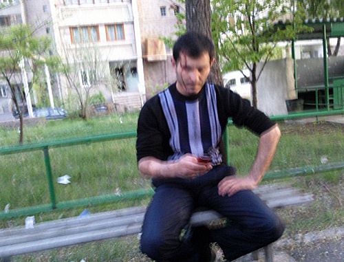 Активист АНК Александр Ахвердян после совершенного на него нападения. Ереван, 22 апреля 2013 г. Фото: http://www.ilur.am