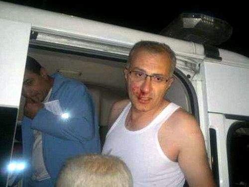 Избитый неизвестными участник акции протеста против вступления Армении в Таможенный союз Айкак Аршамян. Фото с личной страницы активиста в сети Facebook