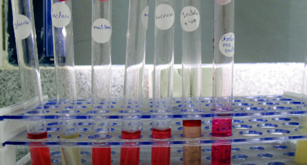 Пробирки с возбудителем холеры в микробиологической лаборатории. Фото: Albaraa Mehdar, http://www.flickr.com/photos/albaraamehdar