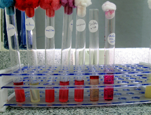 Пробирки с возбудителем холеры в микробиологической лаборатории. Фото: Albaraa Mehdar, http://www.flickr.com/photos/albaraamehdar
