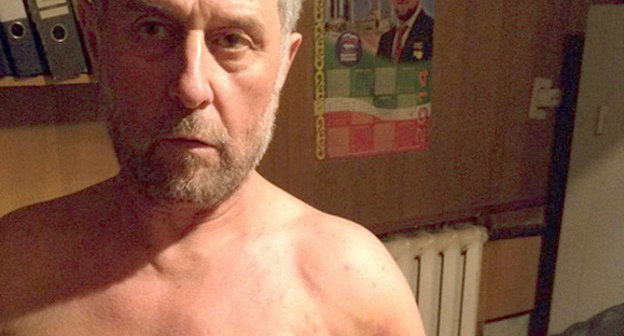 Руслан Кутаев в ИВС Урус-Мартана со следами от пыток. 28 февраля 2014 г. Фото пресс-службы Межрегионального комитета против пыток, http://www.pytkam.net/press-centr.novosti/4017