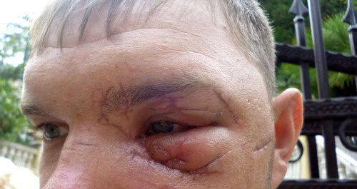 Глаз Егора Лукашова. Сочи, 17 июля 2014 г. Фото Светланы Кравченко для "Кавказского узла"