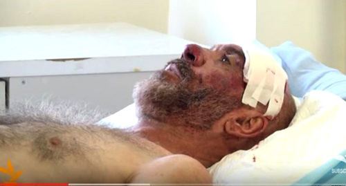 Смбат Акопян в больнице, 21 сентября 2015 год. Фото: http://rus.azatutyun.mobi/a/27262276.html