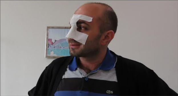 Депутат Национального собрания Нагорного Карабаха, лидер оппозиционной партии "Национальное возрождение" Айк Ханумян  в день выписки из больницы. Степанакерт. 9 июня 2016 год. Фото Алвард Григорян для "Кавказского узла"