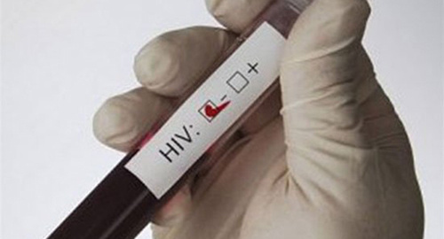 Анализ крови на ВИЧ. Фото http://www.spid.ru/spid/ru/news?page=14