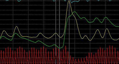 Фрагмент полиграммы: фон — реакция — восстановление — фон. Фото DENker https://ru.wikipedia.org/wiki/Полиграф