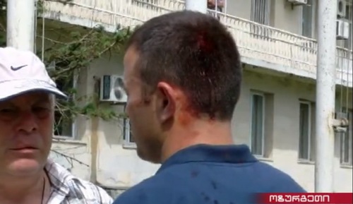 Окровавленный затылок Бесо Катамадзе. Кадр из видео "Рустави 2". http://rustavi2.ge/en/news/106781