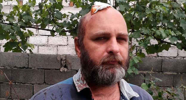 Беслан Кмузов после ранения во время акции протеста в Тбилиси. Фото Ния Хубуная для "Кавказского узла"