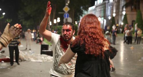 Пострадавший во время акции протеста в Тбилиси. 21 июня 2019 г. Фото: REUTERS/Irakli Gedenidze