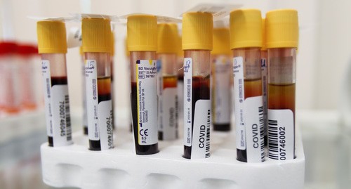Пробирки для тестов на коронавирус. Фото: REUTERS/Maxim Shemetov