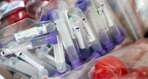 Анализ крови в лаборатории © Фото freestocks, unsplash.com
