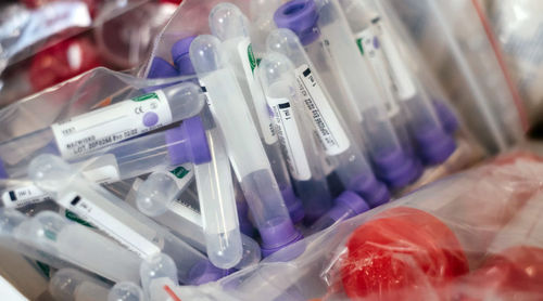 Анализ крови в лаборатории © Фото freestocks, unsplash.com
