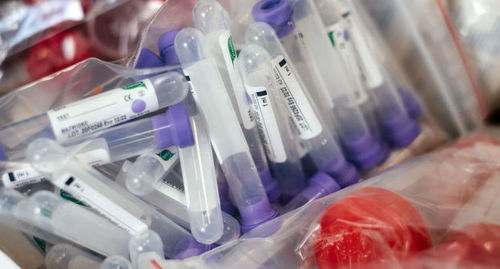 Анализ крови в лаборатории © Фото freestocks, unsplash.com