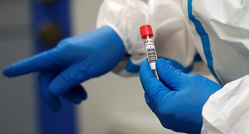 Руки медицинского работника, держащего тест на коронавирус. Фото: REUTERS/Fabrizio Bensch