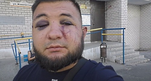 Гаспар Авакян после нападения. Скриншот видео канала Гаспара Авакяна, https://www.youtube.com/watch?v=nETUnhpN56I