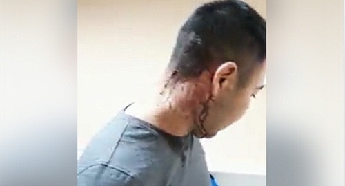 Арслан Кусьминов после нападения. скриншот видео https://www.facebook.com/people/Арслан-Кусьминов/100006289414442