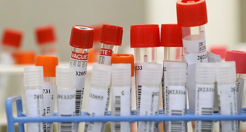 Тест на коронавирус. Фото: REUTERS/Yves Herman