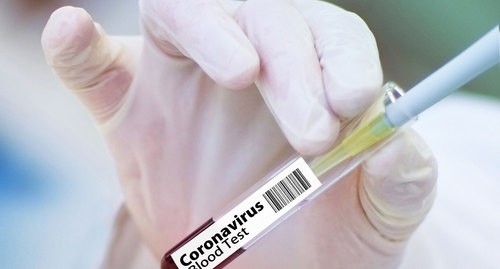 Тест на коронавирус. Фото pixabay.com 