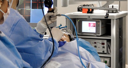 Врач-оториноларинголог проводит операцию на придаточных пазухах носа. Фото: https://upload.wikimedia.org/wikipedia/commons/4/48/Mani_Zadeh_MD_Endoscopic_Sinus_Surgery.jpg