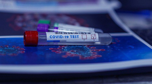 Пробирки для тестирования на коронавирус. Фото: pixabay.com 
