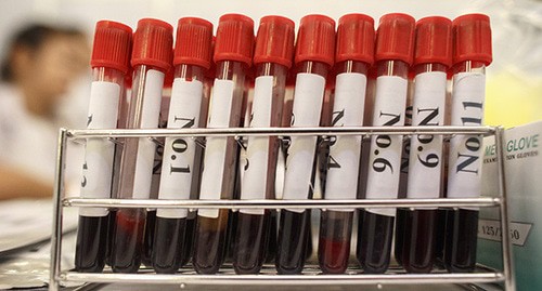 Пробирки с образцами крови для анализа на ВИЧ. Фото: REUTERS/Athit Perawongmetha
