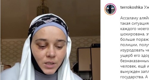 Девушка, переехавшая из религиозных убеждений в Махачкалу, жалуется, что получила серьезные травмы во время драки в местной больнице. Скриншот сообщения https://www.instagram.com/p/CRSEGqEKDtd/
