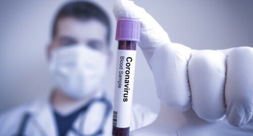 Тест на коронавирус. Фото: https://pixabay.com