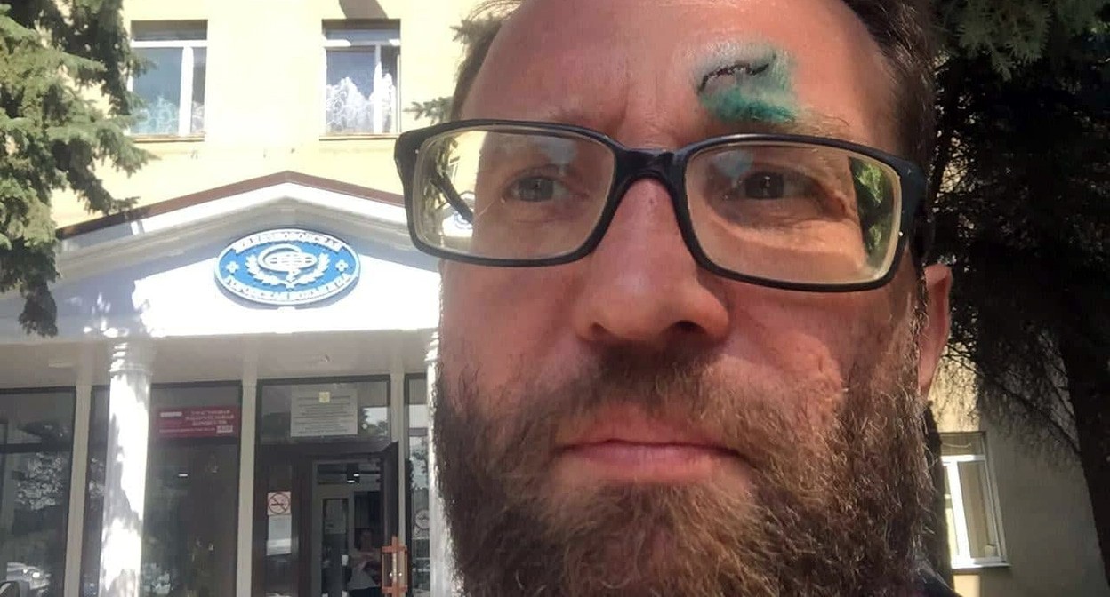 Активист Андрей Фокин. Фото Андрея Фокина - странциа FB  https://www.facebook.com/photo.php?fbid=2872852506118095&set=a.877961962273836&type=3&theater
