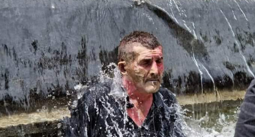 Мужчина, который причинил себе повреждения во время акции противников ЛГБТ у парламента Грузии . Фото с сайта  https://cnews.ge/home/news_description/36761/